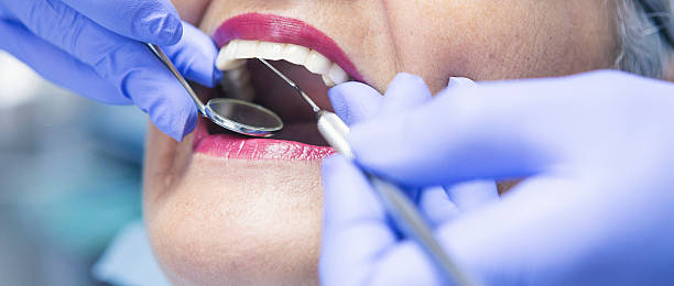 Best Emergency Denture Repair in Peabody, KS
